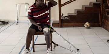 Amid escalating violence in Eastern Congo, demand for prosthetics soars